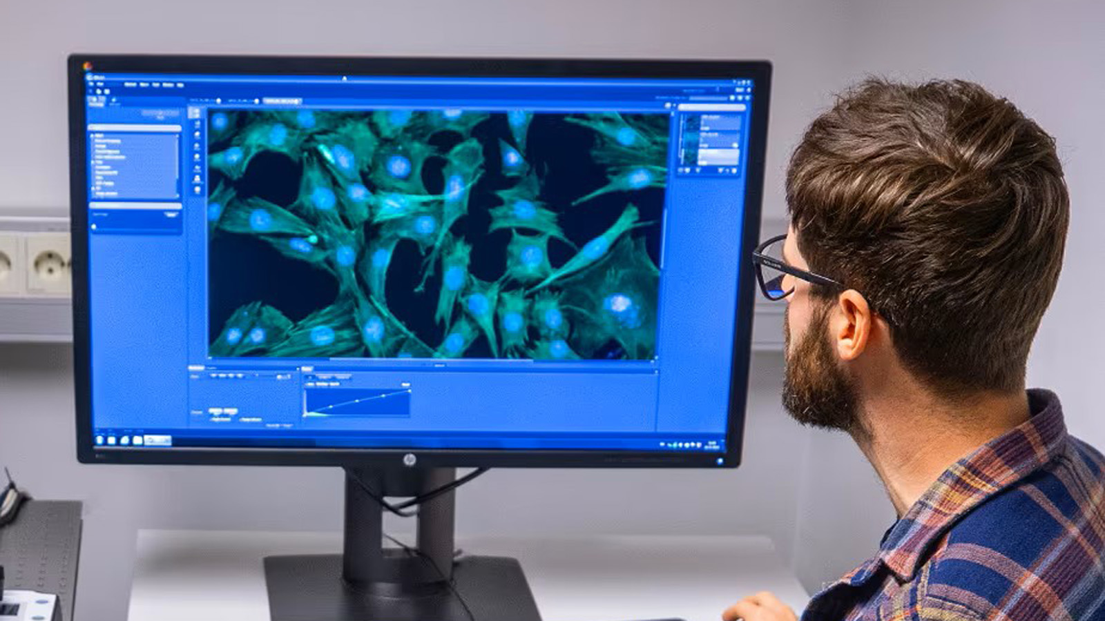Forskeren studerer og analyserer bilde av muskler på PC